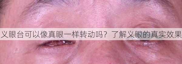 义眼台可以像真眼一样转动吗？了解义眼的真实效果