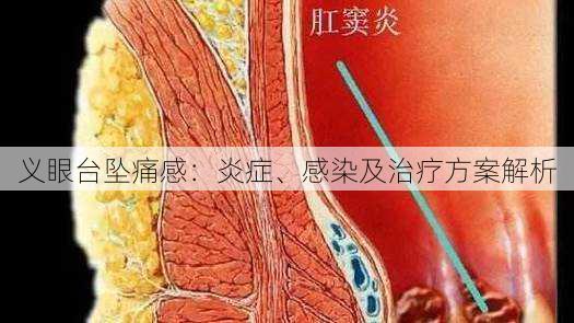 义眼台坠痛感：炎症、感染及治疗方案解析