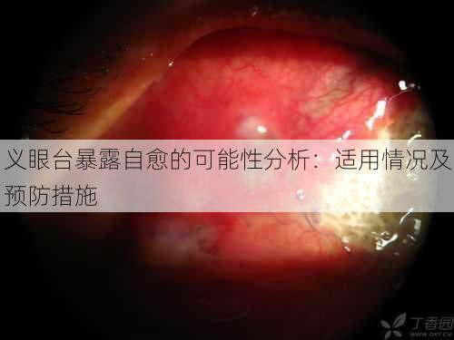 义眼台暴露自愈的可能性分析：适用情况及预防措施