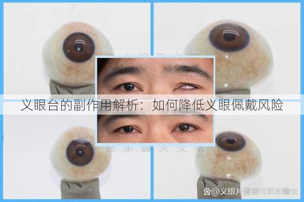 义眼台的副作用解析：如何降低义眼佩戴风险