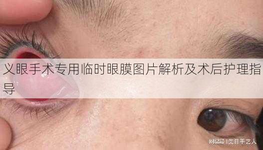 义眼手术专用临时眼膜图片解析及术后护理指导