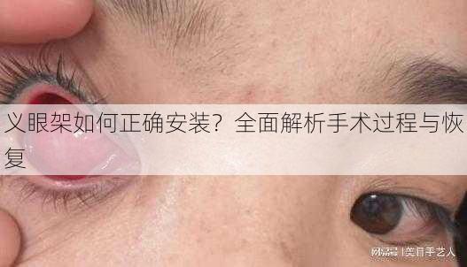 义眼架如何正确安装？全面解析手术过程与恢复