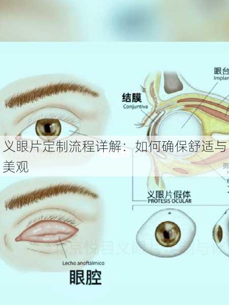 义眼片定制流程详解：如何确保舒适与美观