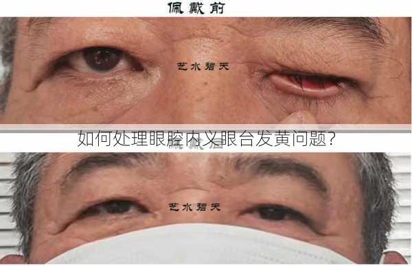 如何处理眼腔内义眼台发黄问题？