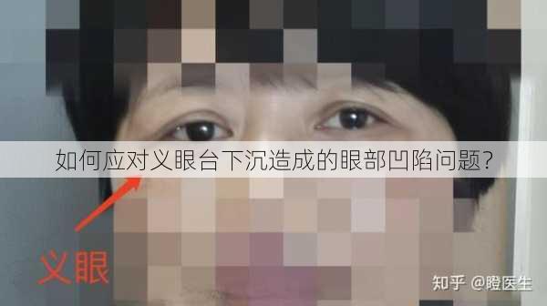 如何应对义眼台下沉造成的眼部凹陷问题？