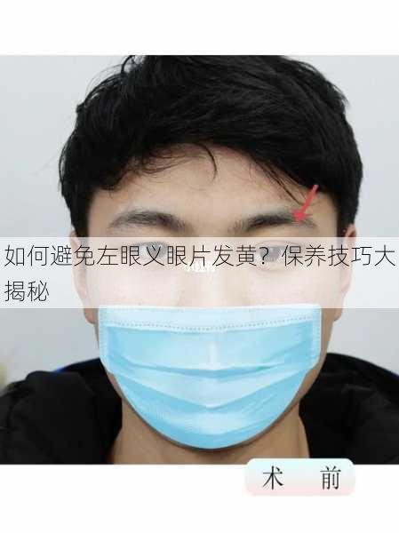 如何避免左眼义眼片发黄？保养技巧大揭秘