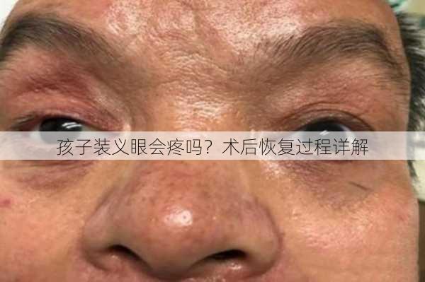 孩子装义眼会疼吗？术后恢复过程详解