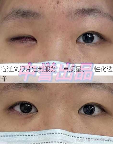 宿迁义眼片定制服务：高质量、个性化选择