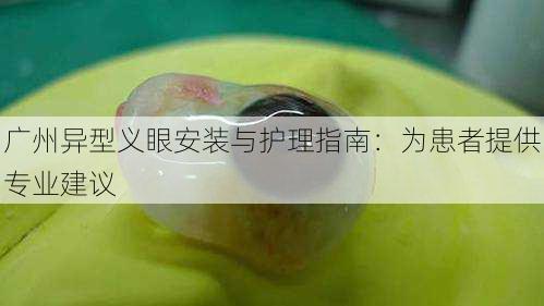 广州异型义眼安装与护理指南：为患者提供专业建议