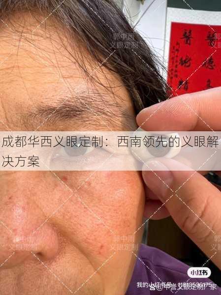 成都华西义眼定制：西南领先的义眼解决方案