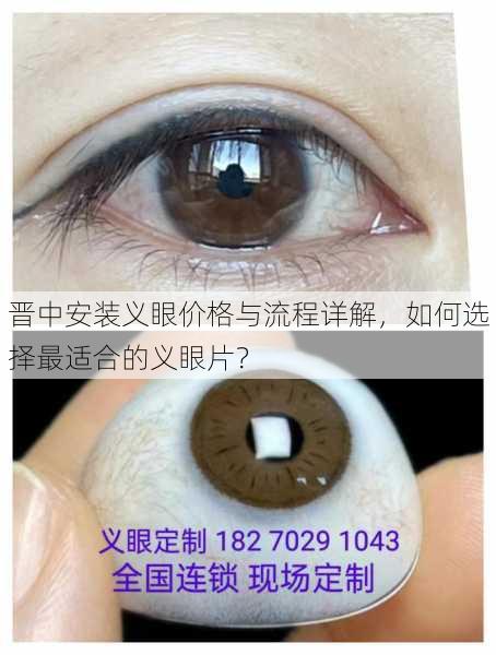 晋中安装义眼价格与流程详解，如何选择最适合的义眼片？