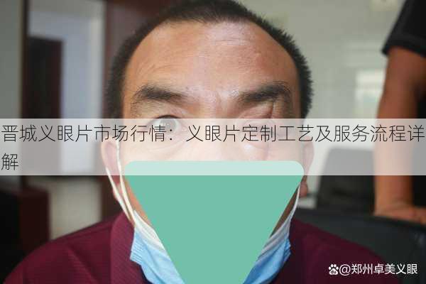晋城义眼片市场行情：义眼片定制工艺及服务流程详解