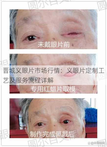 晋城义眼片市场行情：义眼片定制工艺及服务流程详解
