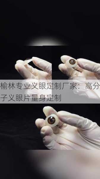 榆林专业义眼定制厂家：高分子义眼片量身定制