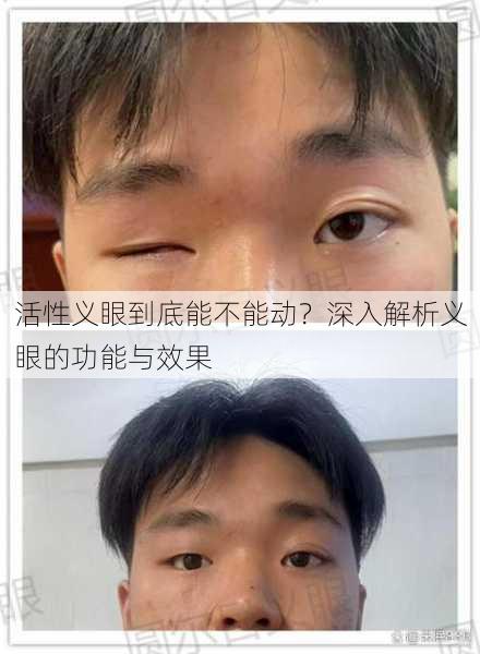 活性义眼到底能不能动？深入解析义眼的功能与效果