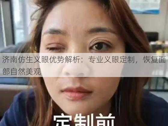 济南仿生义眼优势解析：专业义眼定制，恢复面部自然美观