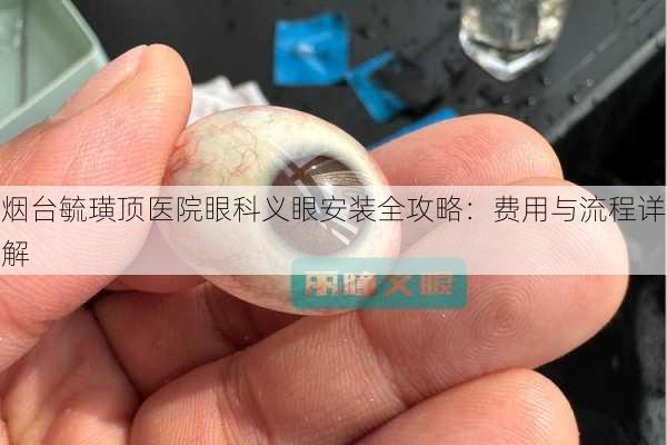 烟台毓璜顶医院眼科义眼安装全攻略：费用与流程详解