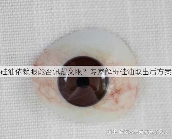 硅油依赖眼能否佩戴义眼？专家解析硅油取出后方案