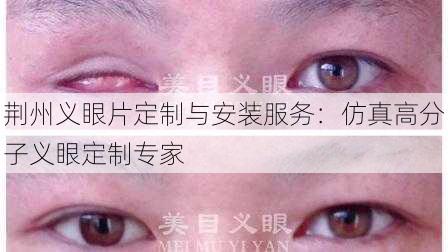 荆州义眼片定制与安装服务：仿真高分子义眼定制专家