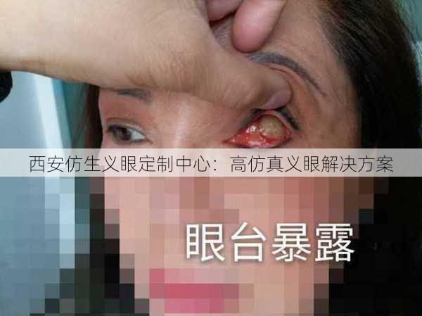 西安仿生义眼定制中心：高仿真义眼解决方案