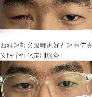 西藏超轻义眼哪家好？超薄仿真义眼个性化定制服务！