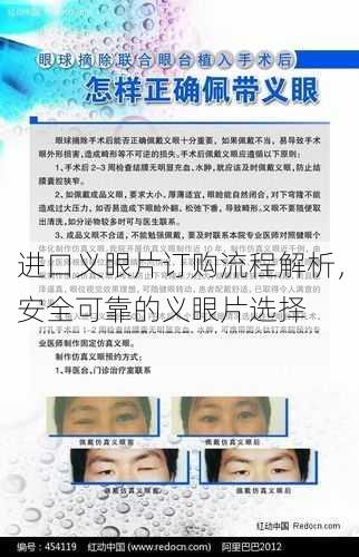 进口义眼片订购流程解析，安全可靠的义眼片选择