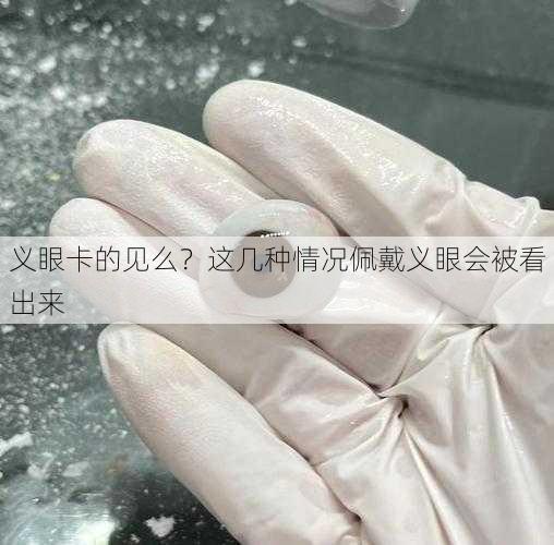 义眼卡的见么？这几种情况佩戴义眼会被看出来