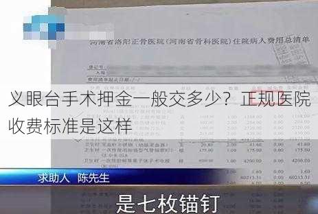 义眼台手术押金一般交多少？正规医院收费标准是这样