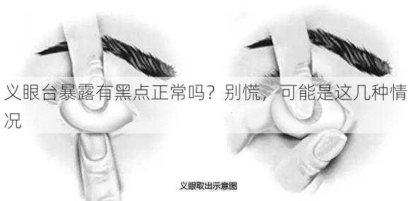 义眼台暴露有黑点正常吗？别慌，可能是这几种情况