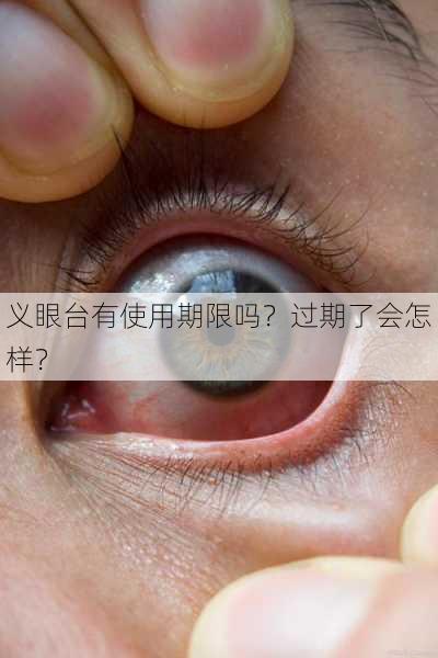 义眼台有使用期限吗？过期了会怎样？