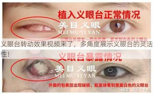 义眼台转动效果视频来了，多角度展示义眼台的灵活性！