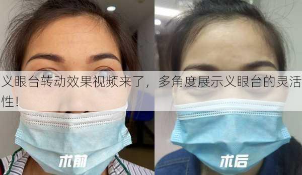 义眼台转动效果视频来了，多角度展示义眼台的灵活性！