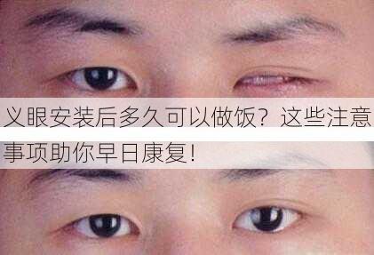 义眼安装后多久可以做饭？这些注意事项助你早日康复！