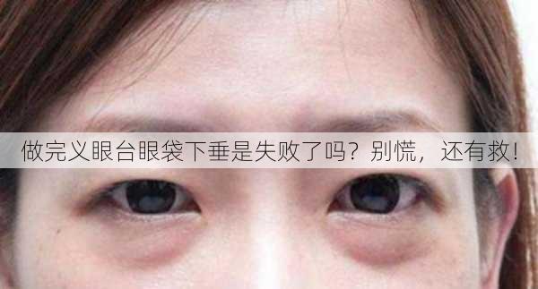 做完义眼台眼袋下垂是失败了吗？别慌，还有救！