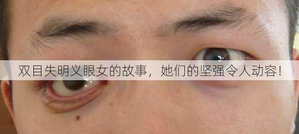 双目失明义眼女的故事，她们的坚强令人动容！