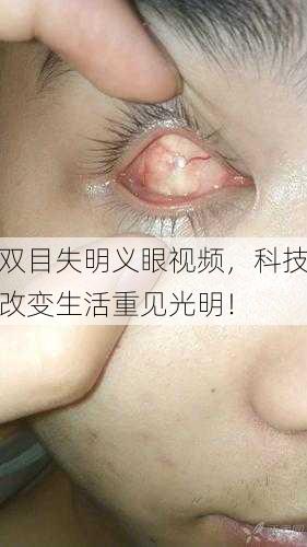 双目失明义眼视频，科技改变生活重见光明！