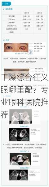 干燥综合征义眼哪里配？专业眼科医院推荐