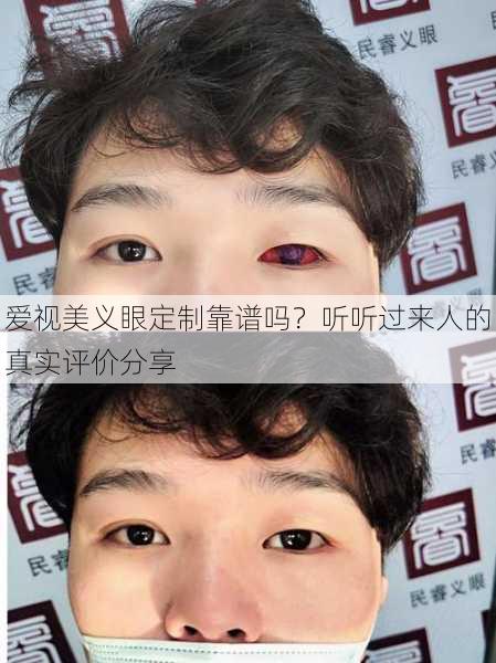 爱视美义眼定制靠谱吗？听听过来人的真实评价分享