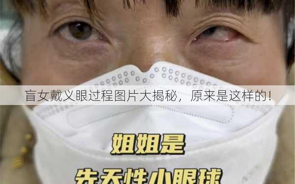 盲女戴义眼过程图片大揭秘，原来是这样的！