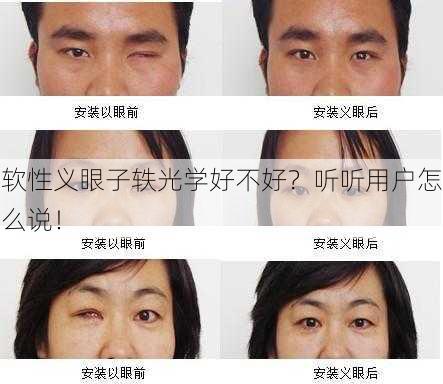 软性义眼子轶光学好不好？听听用户怎么说！
