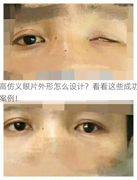 高仿义眼片外形怎么设计？看看这些成功案例！