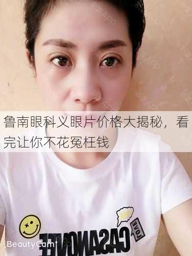 鲁南眼科义眼片价格大揭秘，看完让你不花冤枉钱