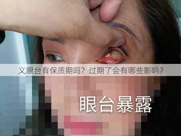 义眼台有保质期吗？过期了会有哪些影响？