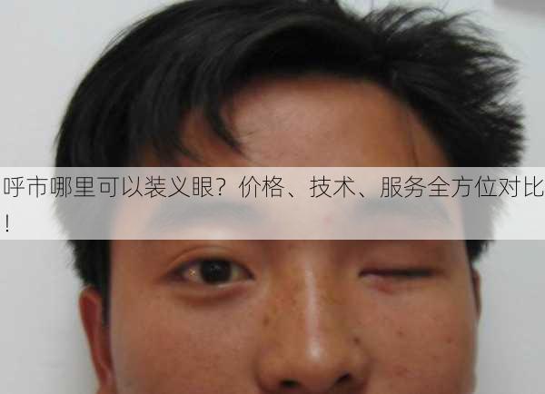 呼市哪里可以装义眼？价格、技术、服务全方位对比！
