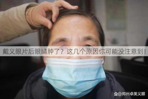 戴义眼片后眼睛肿了？这几个原因你可能没注意到！