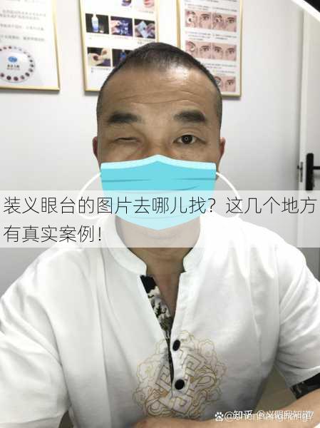 装义眼台的图片去哪儿找？这几个地方有真实案例！