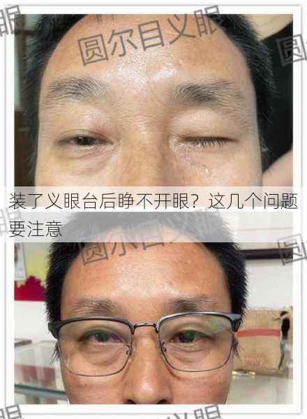 装了义眼台后睁不开眼？这几个问题要注意