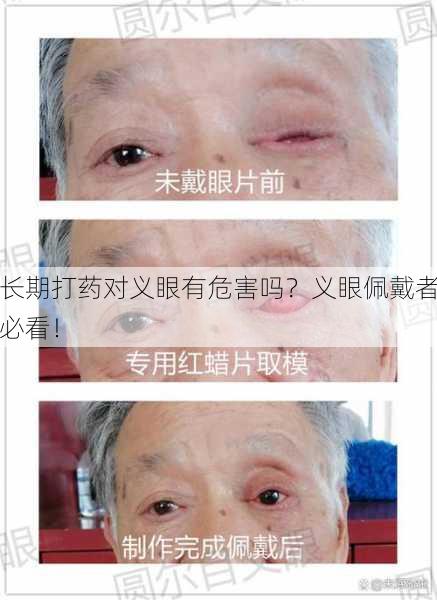长期打药对义眼有危害吗？义眼佩戴者必看！