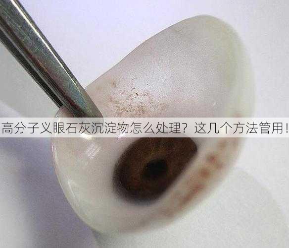高分子义眼石灰沉淀物怎么处理？这几个方法管用！