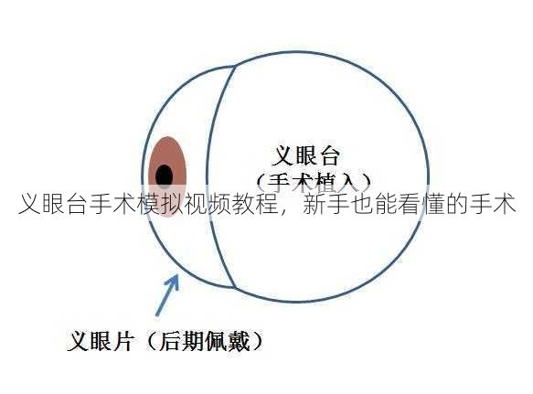 义眼台手术模拟视频教程，新手也能看懂的手术